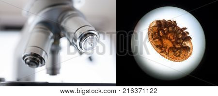 Varroa Destructor Bee Parasite - Microscope Photo