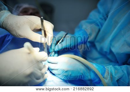 hand surgeon makes an operation closeup. surgical instruments