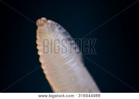Macro Photo Of Adult Toxocara Canis, Dog Roundworm