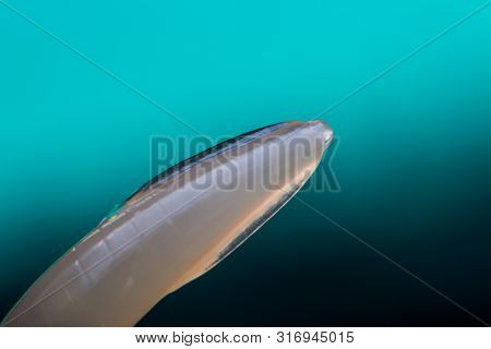 Macro Photo Of Adult Toxocara Canis, Dog Roundworm