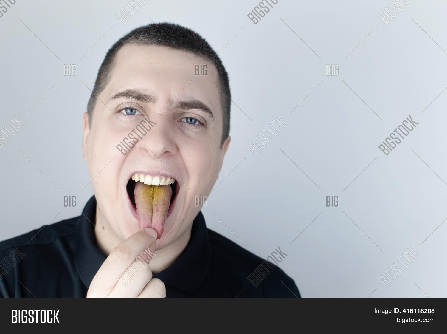 Man Has Yellow Tongue Image & Photo (Free Trial) Bigstock