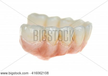 Dental Health Care. Ceramic Zirconium In Final Version. Close Up Dental Prosthesis On Zirconium Oxid