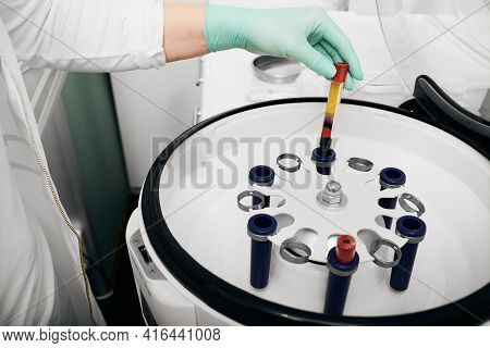 Preparation Of Blood Plasma In A Centrifuge For Plasmolifting And Cosmetic Procedures For Skin Rejuv