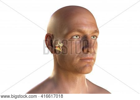 Otitis Media, A Group Of Inflammatory Diseases Of The Middle Ear, 3d Illustration Showing A Male Per