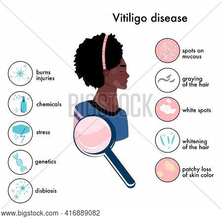 World Vitiligo Day.infographics Icons With Symptoms And Reasons Of Autoimmune Sickness.skin Disease.