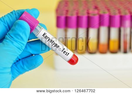 Blood sample for karyotype (abnormal chromosome study) testing