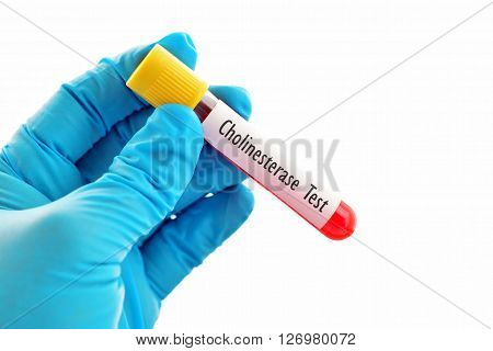 Test tube with blood sample for cholinesterase test