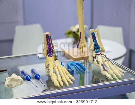 Traumatology / Osteosynthesis Surgery Bone Locking Plates System