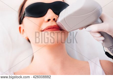 Young Beautiful Woman Doing Laser Hair Removal Of The Upper Lip Concept. Body Care. Beauty. Laser Ha