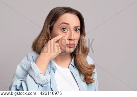 Woman With Yellow Eyes On Grey Background. Liver Problems Symptom