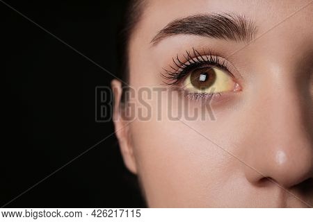 Woman With Yellow Eyes On Black Background, Closeup And Space For Text. Liver Problems Symptom