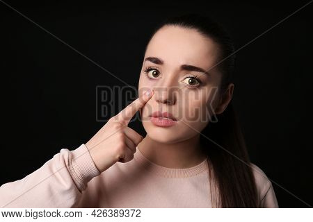 Woman Checking Her Health Condition On Black Background. Yellow Eyes As Symptom Of Problems With Liv
