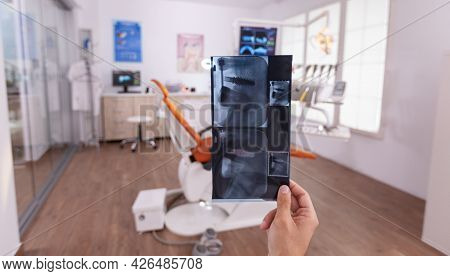 Orthodontist Man Doctor Holding Teeth Medical Radiography Planning Healthcare Teethcare Treatment Fo