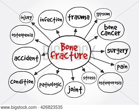 Bone Fracture Mind Map, Concept For Presentations And Reports