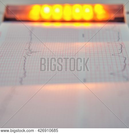 Ctg Device With Monitoring Of The State Of Health Of The Mother And Child During Childbirth In The H