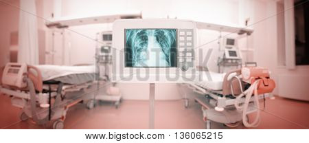X-ray monitor in the panoramic ICU ward.