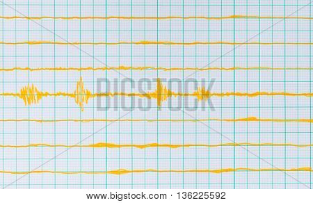 Seismological Device Sheet - Seismometer