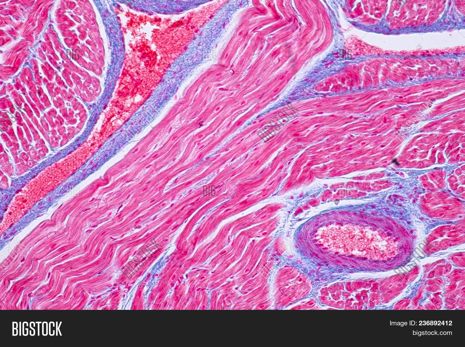 Human Muscle Tissue Under Microscope - Micropedia