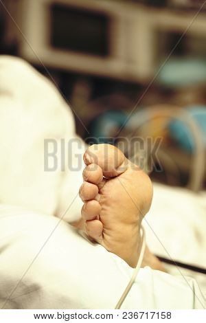 Foot Of An Exhausted Senior Patient On A White Bed In The Advanced Stage Of A Disease, Concept Of A 