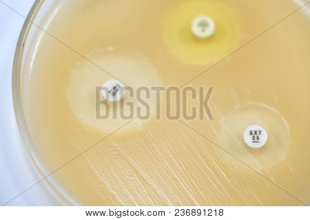 Antibiotic Sensitivity Of Bacteria By Means Of Diffusion Test Is A Test. Microbiology
