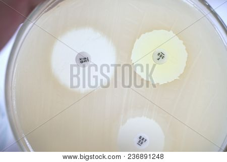 Antibiotic Sensitivity Of Bacteria By Means Of Diffusion Test Is A Test. Microbiology