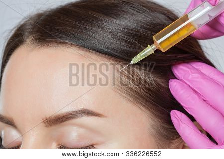 Cosmetologist Does Prp Therapy Against Hair Loss Of A Beautiful Woman In A Beauty Salon. Cosmetology