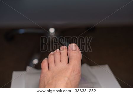 Podiatrist Treating Toenail. Podology Treatment. Podology Of Applying Gel Polish To Remove Onycholys