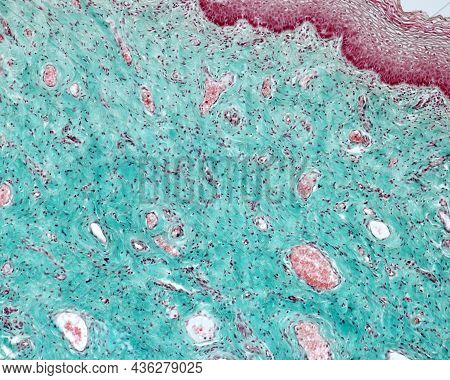 Vaginal Mucosa Showing The Non-keratinized Stratified Squamous Epithelium And The Connective Tissue 