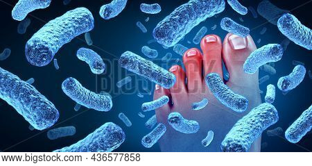 Foot Bacteria Disease Causing A Smelly Odor As A Human Body Showing Toes With Bacterial Infection Da