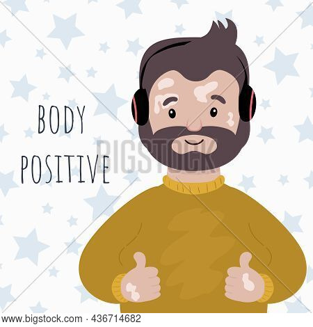 Cartoon Man With Vitiligo, Depigmentation Disease. Vector Illustration In Hand Drawn Flat Style