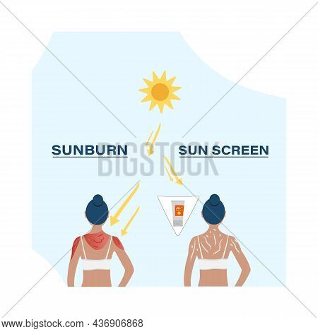 Uv Care Before After Image, Young Girl Puts On The Sunscreen Or Not