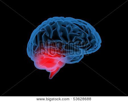 X-ray Brain Pathology