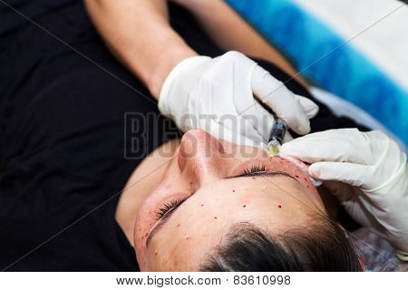 Injections On The Face With Cosmetic Procedures.