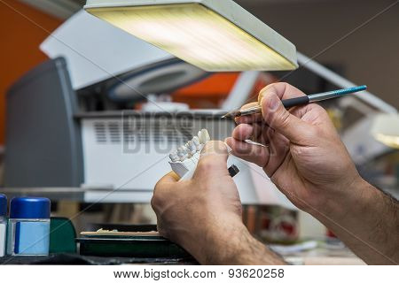 Production Dentures