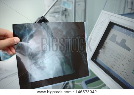 X-ray in doctor's hand at the patient bedside.