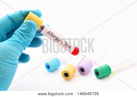 Test tube with blood sample for allergy test