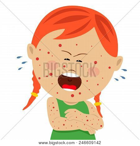 Little Sick Girl With Chickenpox Crying Isolated On Background