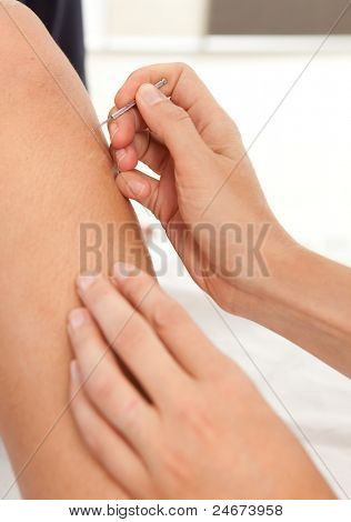 Shonishin japonské dětské akupunktura štětec se používá na noze mladých mužských pacientů.