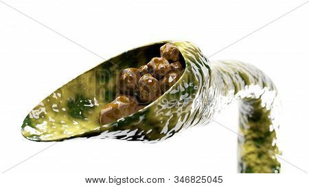Gallstones Blockage In Gallbladder 3d Render Illustration