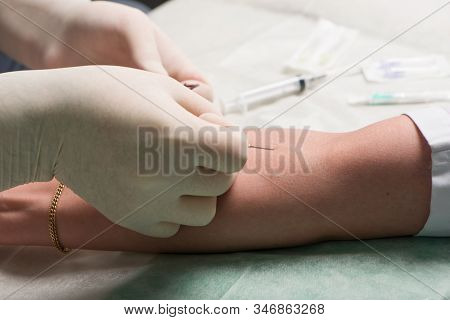 Hands In Latex Medical Gloves Perform Vein Puncture In Ulnar Bend Of Patient S Hand