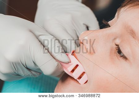 The Boy Orthodontist Makes A Fitting For The Plate.