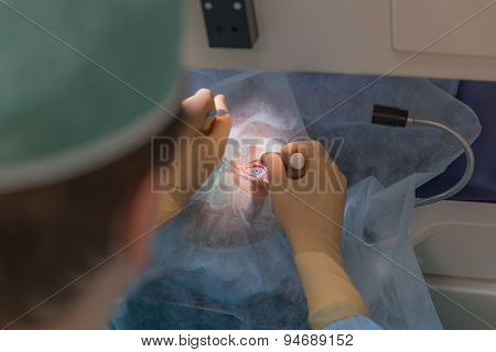 Ophthalmology femto lasik operation