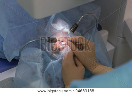 Ophthalmology femto lasik operation