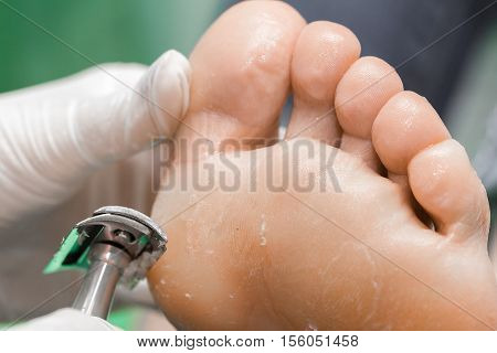 Pedicure  procedure in the beauty salon.  emover calluses on the feet. Foot care.