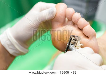 Pedicure  procedure in the beauty salon.  emover calluses on the feet. Foot care.
