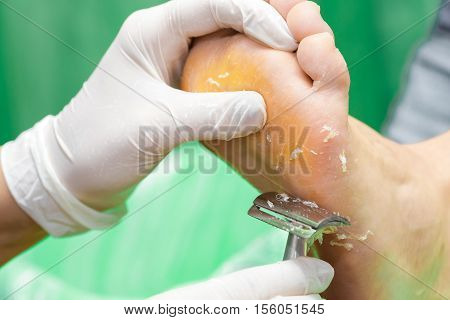 Pedicure  procedure in the beauty salon.  emover calluses on the feet. Foot care.