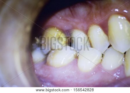 Dentists Dental Teeth Photo