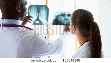 Doctors analyzing an x-ray in a meting