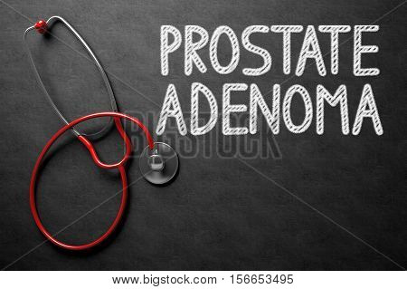 Medical Concept - Prostate Adenoma Handwritten on Black Chalkboard. Top View Composition with Chalkboard and Red Stethoscope. Black Chalkboard with Prostate Adenoma - Medical Concept. 3D Rendering.