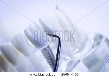 Dentist Cleaning Teeth